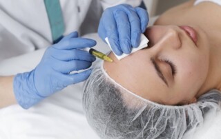Botox Injection